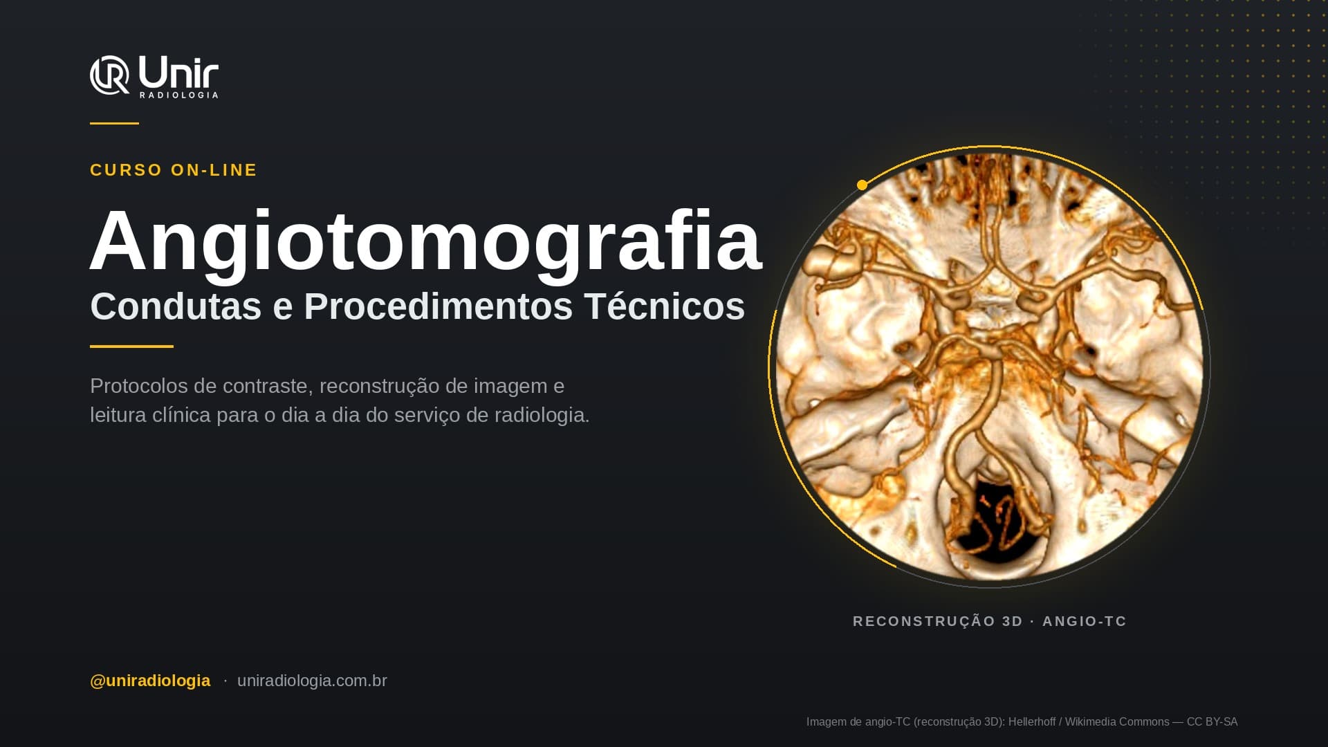 Condutas e procedimentos técnicos de Angiotomografia
